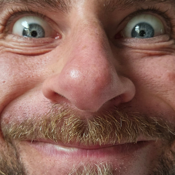 X-Ray Ted – X-Ray Ted – Only You